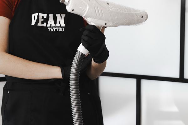 laser tattoo lightening procedure in progress