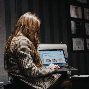 lazerinis tatuiruočių šviesinimas Šiauliuose