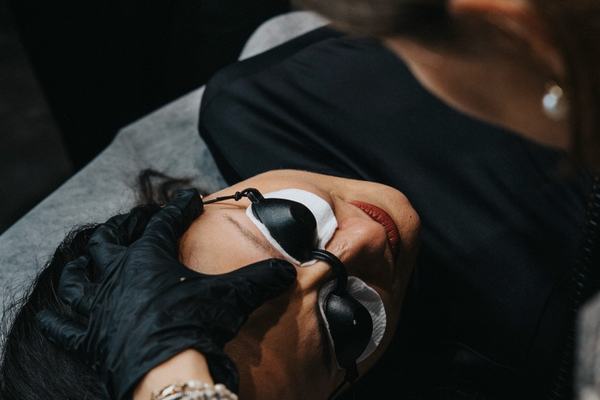 laser lightening of permanent makeup in eyebrow area