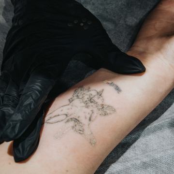 tatuiruotės pigmento reakcija į lazerio poveikį procedūros metu