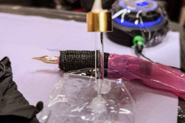 tatuiruotės šviesinimo rėmoveriu procedūra