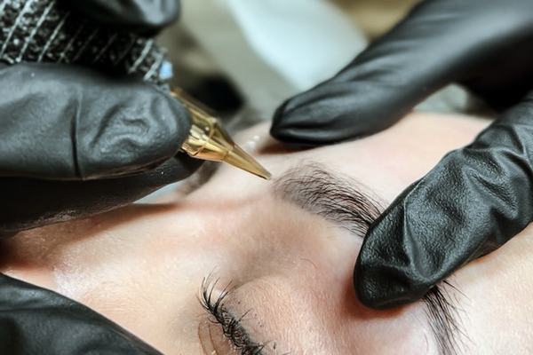 specialistas atlieka tatuiruotės šviesinimą rėmoveriu