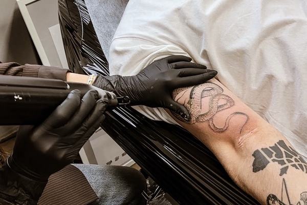 makiažo šviesinimo lazeriu kursas