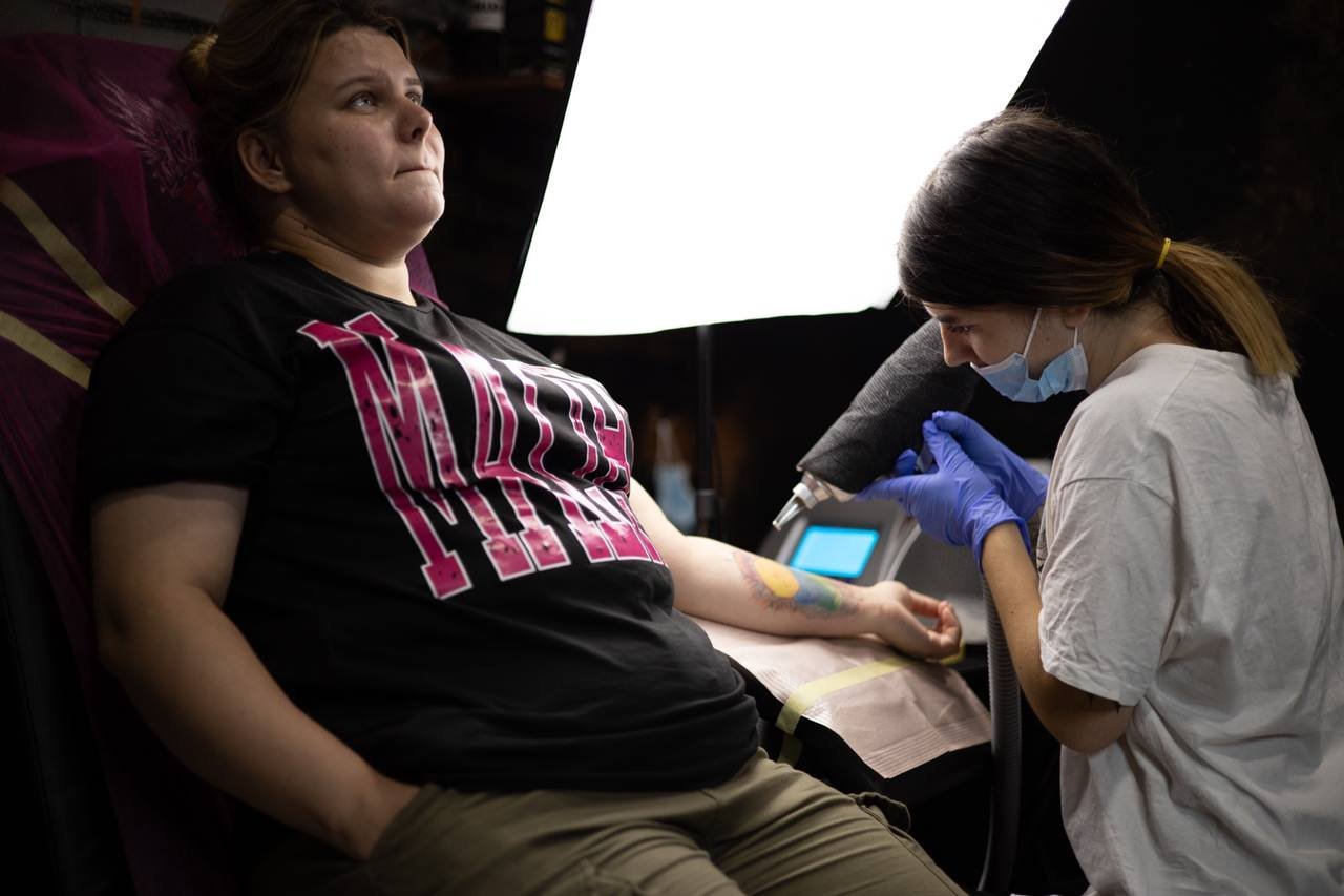 Laser tattoo removal in Vilnius