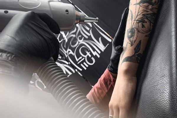 Tattoo removal in Panevezys