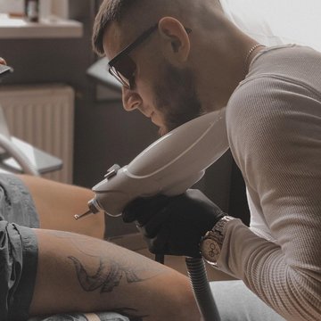 Laser tattoo removal in Kaunas