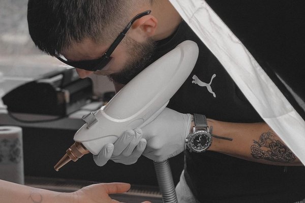 Laser tattoo removal in Kaunas