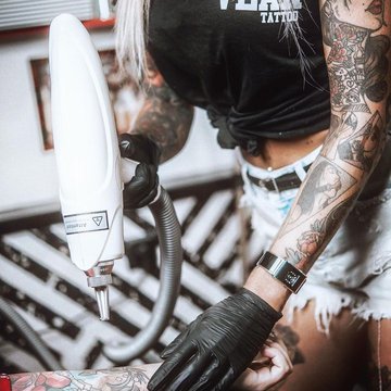 Tatuiruočių šalinimas Vilniuje
