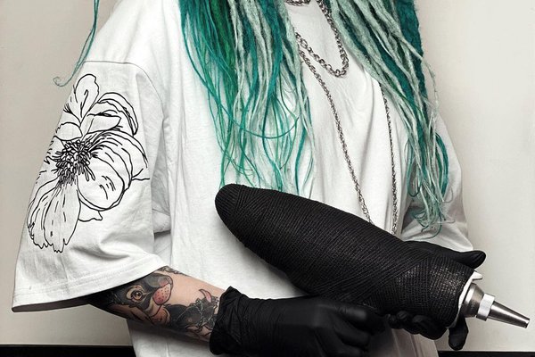 Tatuiruočių šalinimas Vilniuje