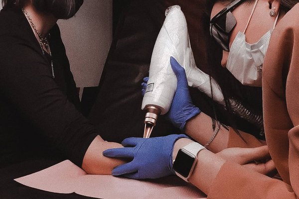 Tatuiruotės šalinimas Šiauliuose
