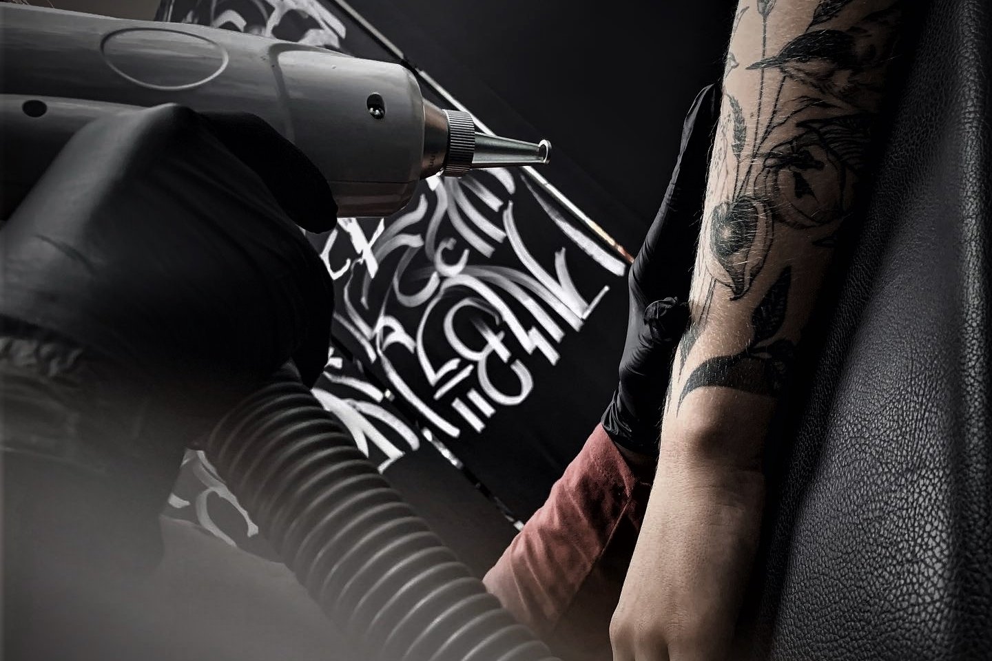 Tatuiruotės šalinimas Šiauliuose