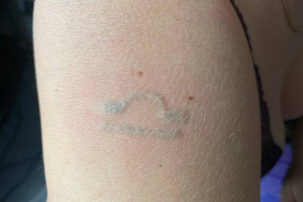 tatuiruočių šviesinimo rėmoveriu mokymai praktikos metu